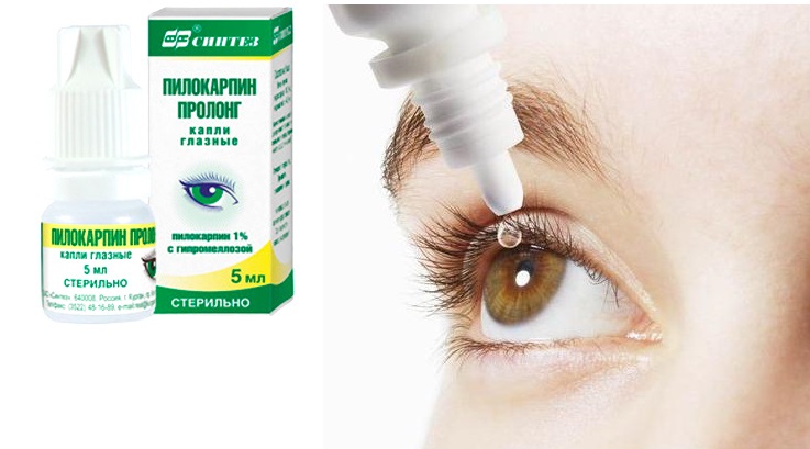 Глазные капли Пилокарпин: инструкция по применению, показания, действие