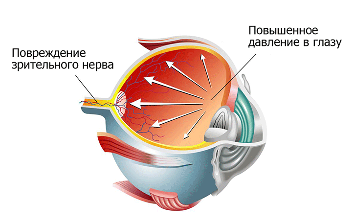 Глазные капли Пилокарпин: инструкция по применению, показания, действие